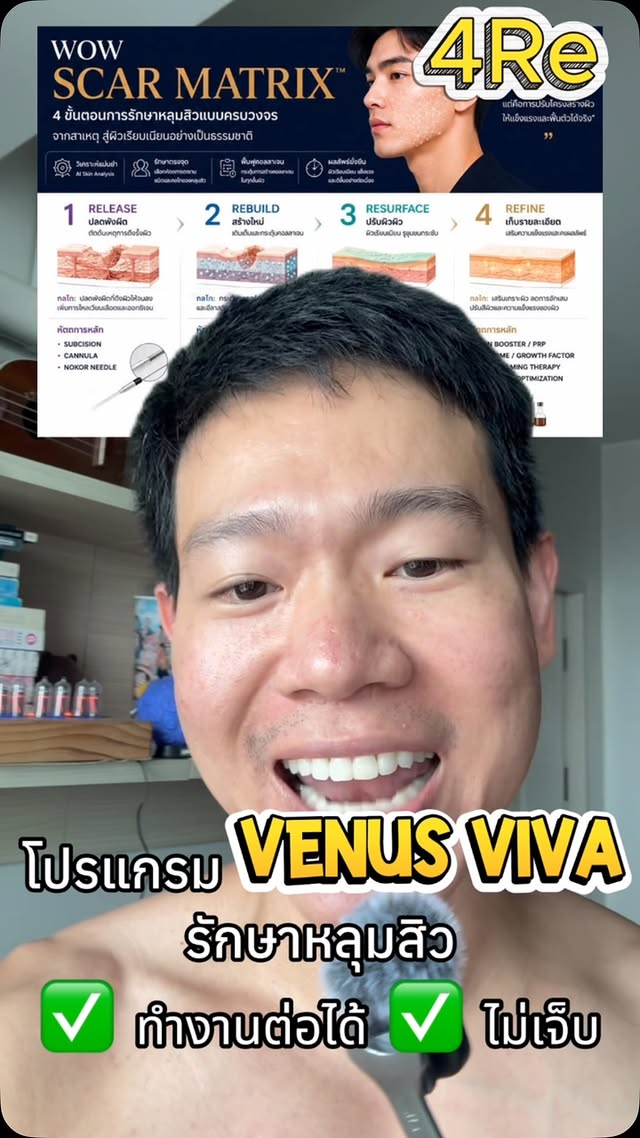 Venus Viva at WOW Clinic